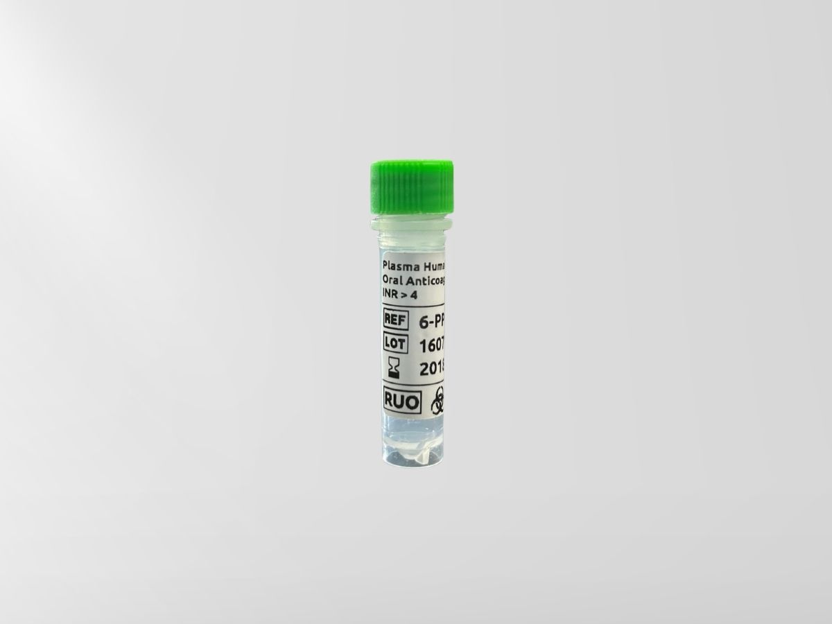 Plasma avec anticoagulant oral – INR ≥ 4,00